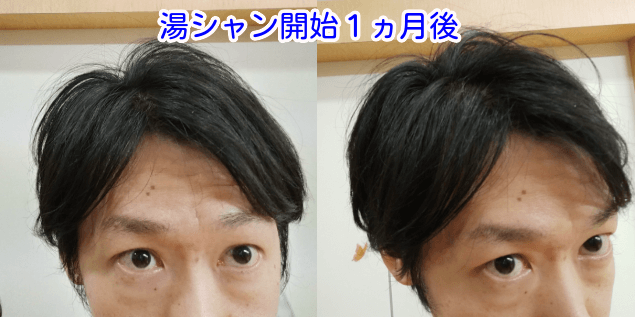 湯シャン1ヶ月後写真