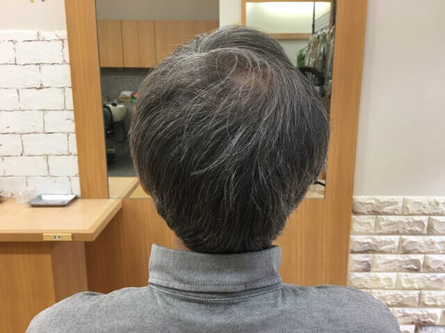 カラートリートメント2回目前の写真