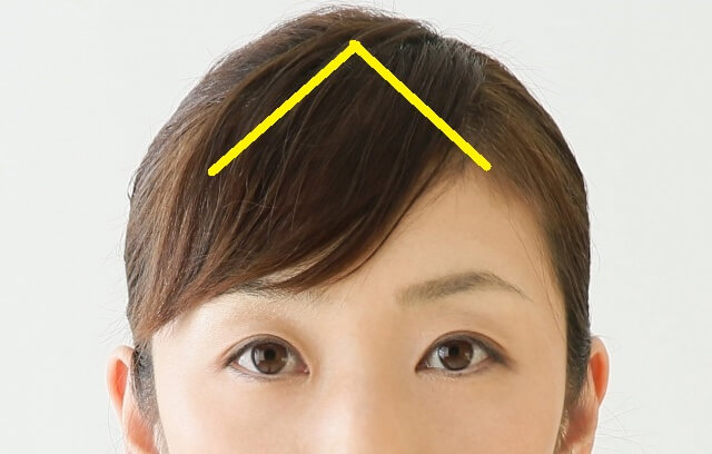 普通の前髪の取り方を示した写真
