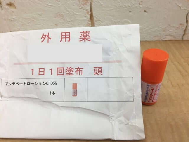 頭皮湿疹の薬