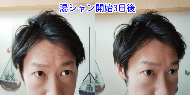 湯シャン開始3日後写真