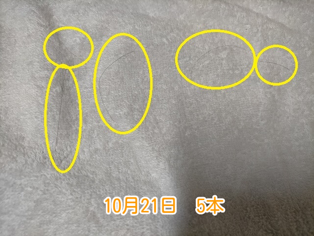10月21日抜け毛本数