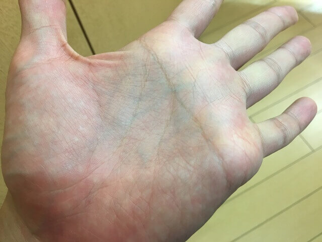 手に残ったカラートリートメント翌日の写真