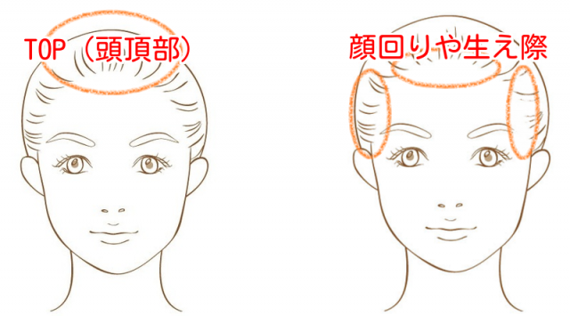 白髪の生えやすい場所を説明したイラスト画像