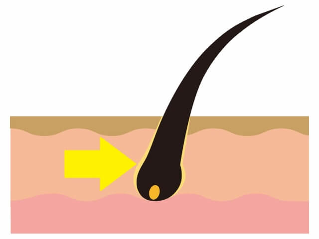毛包のイラスト