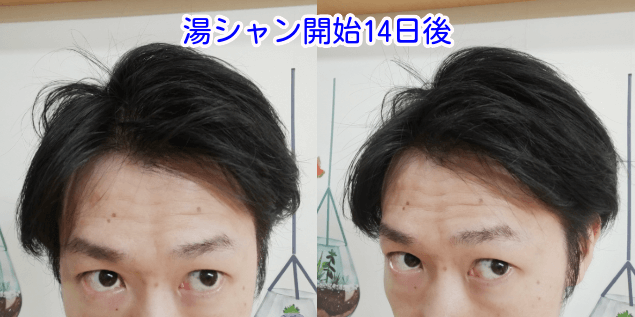 湯シャン開始14日後写真