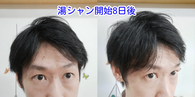 湯シャン開始8日後写真