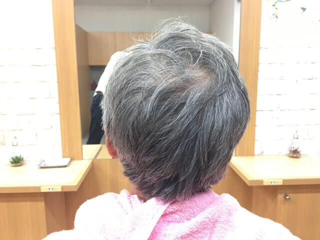 カラートリートメントを使う前の白髪の写真