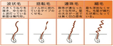 くせ毛の種類の写真