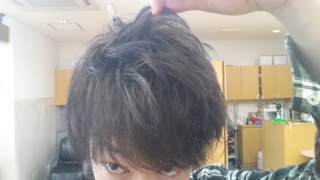 黒染め後8日目の写真 根元