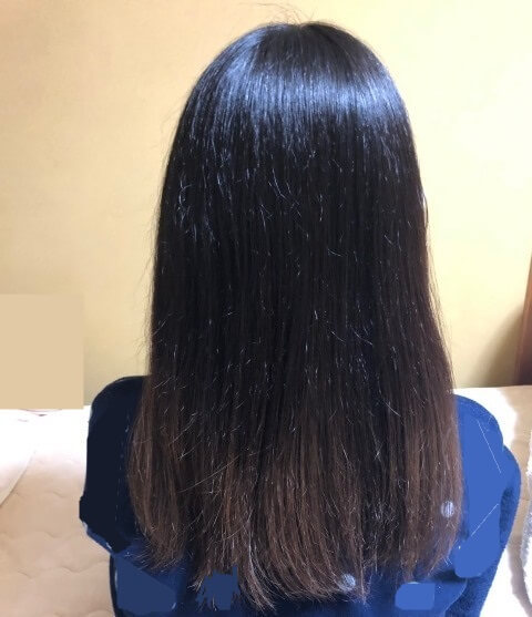 酸熱トリートメント2日後