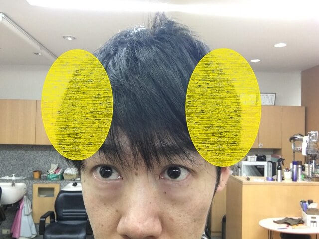 人間のハチの部分の写真