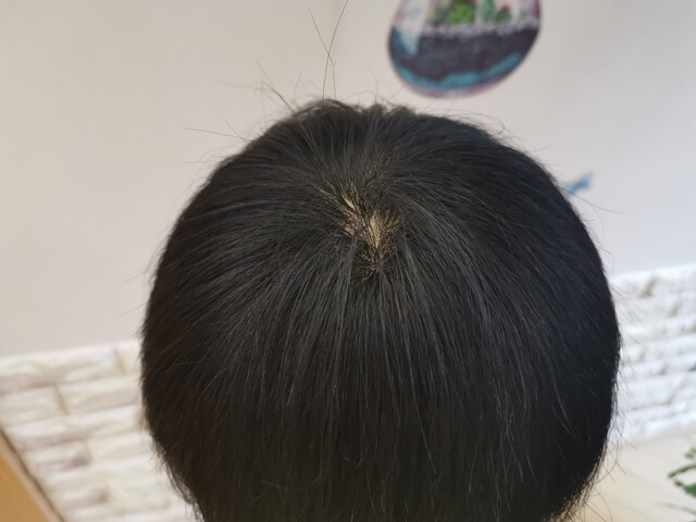 黒染めしたブリーチ毛のアップ