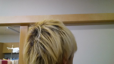 さらにホワイトブリーチする前の写真 右後頭部