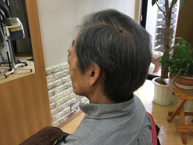 カラートリートメント2回目後の写真