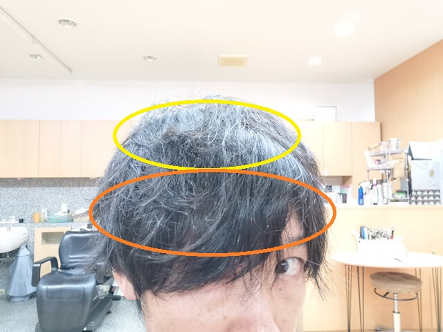 メンズの縮毛矯正範囲一例
