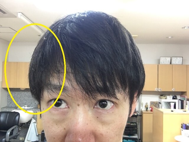 両方洗い流さないトリートメントを付けた髪の写真