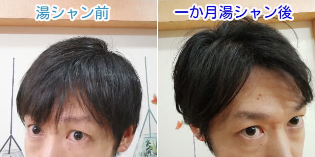 湯シャン前と一か月湯シャン後