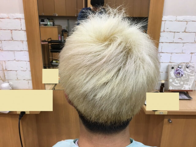 ホワイトブリーチ終了後ドライ後の写真