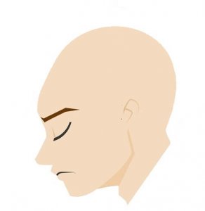 全頭型円形脱毛症の症状の画像